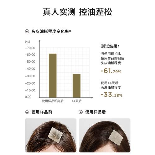 买1发4RNW控油空气感控油洗发水