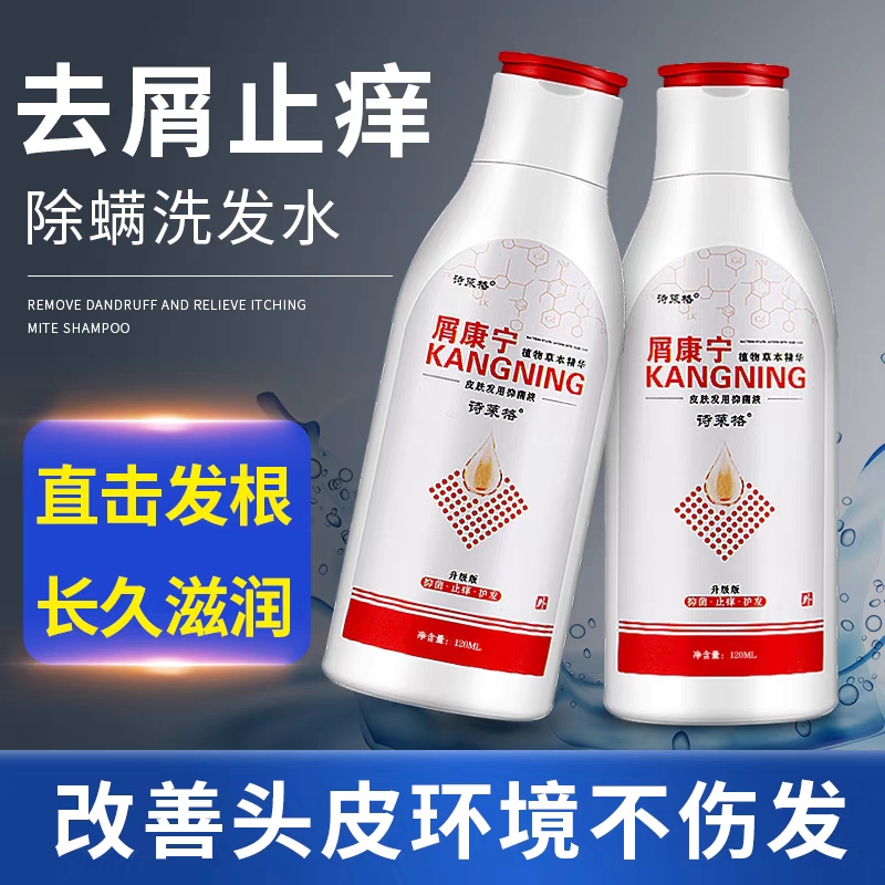 药店同款屑康宁去屑止痒洗发水抑菌除螨虫毛囊头痒去头屑男女专用