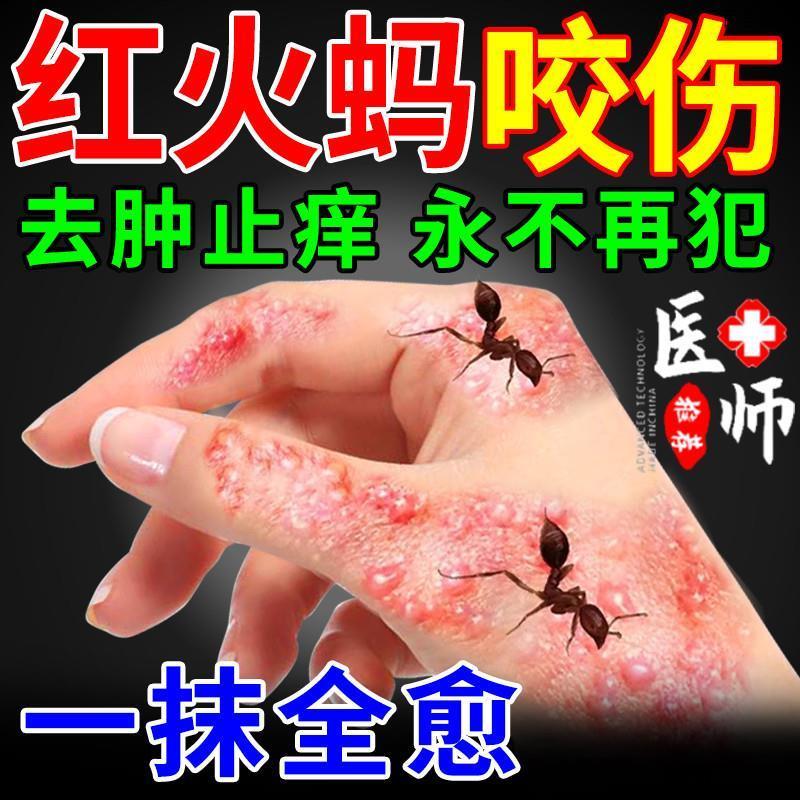 红火蚁蚂蚁咬伤药膏蚊虫叮咬隐翅虫毒虫跳蚤螨虫止痒消肿过敏专用