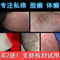 股廯癣药止痒膏皮肤瘙痒抑菌杀菌阴囊私处外用药正品大腿内侧男士