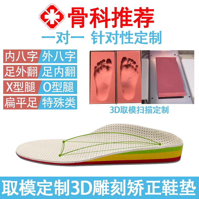 3D打印定制扁平足外翻内八字矫正鞋垫XO型腿矫形器足弓垫儿童成人