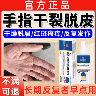 手癣膏脱皮干裂真菌感染鹅掌风专用膏角化型湿疹喷剂开裂起皮痒WY