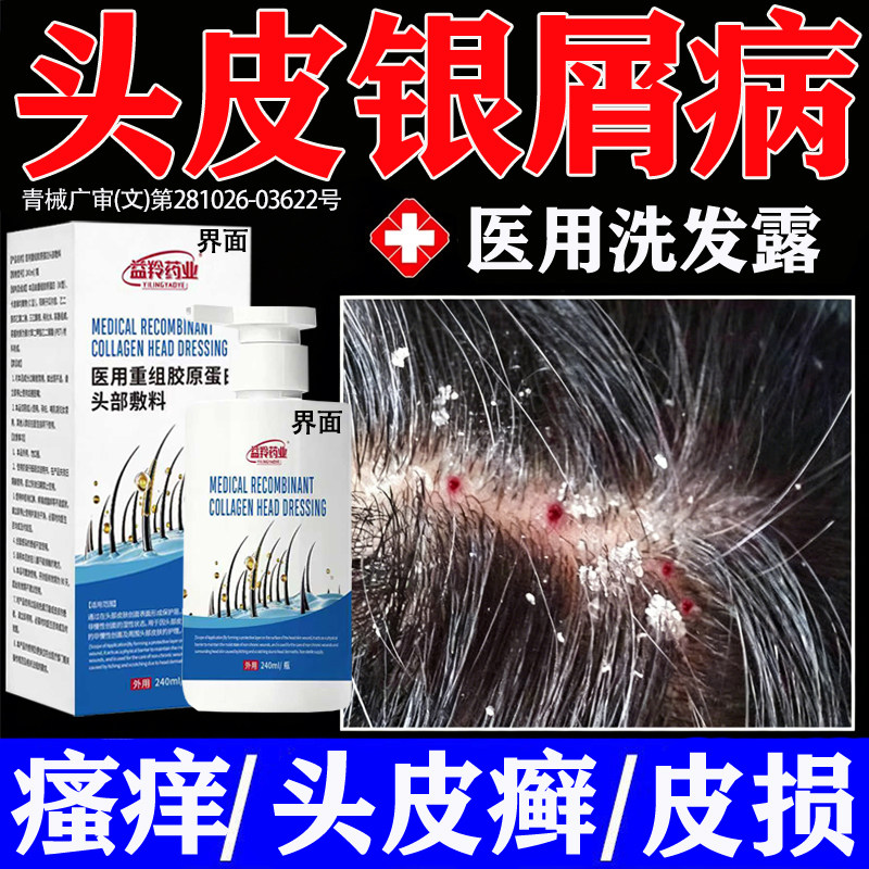 治疗头皮牛皮癣银屑专用官方旗舰店进口特效瘙痒疙瘩真菌感染发PP