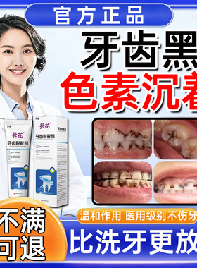 牙齿黑色素沉淀去除黑斑黑线黑牙渍儿童牙菌斑牙膏污垢祛除神器WY