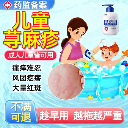 儿童急慢性胆碱性寻荨麻疹过敏止痒疹沐浴露根止痒膏提高免疫力UU