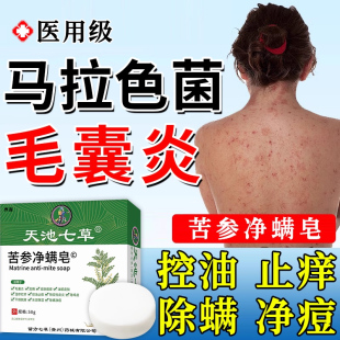 背上长痘痘毛囊炎沐浴露除螨祛痘痒硫磺香皂马拉色菌药真菌感染UU