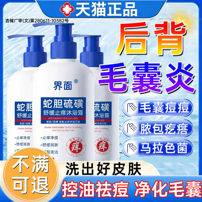 后背毛囊炎马拉色菌去除前胸后背长痘痘祛痘除螨止痒硫磺沐浴露WW