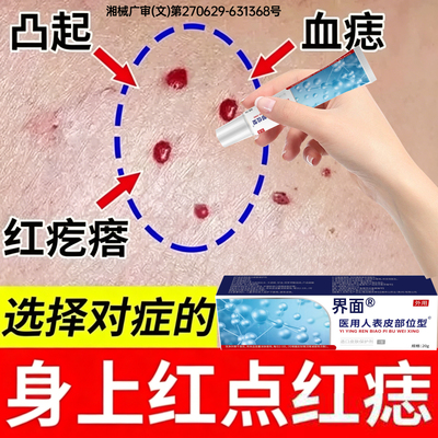 血管瘤血管痣去除樱桃状血管瘤点红痣蜘蛛痣去身上红痣黑疙瘩PP