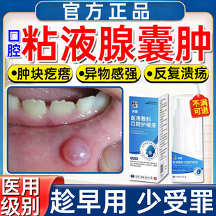 口腔粘液腺囊肿导管堵塞下唇长疙瘩水泡口腔溃疡异物感抑菌消炎WY