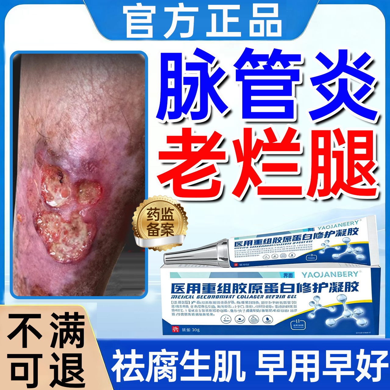脉管炎老烂腿专用膏伤口愈合结痂下肢小腿溃烂发黑祛腐生肌凝胶UU