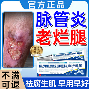 脉管炎老烂腿专用膏伤口愈合结痂下肢小腿溃烂发黑祛腐生肌凝胶WY