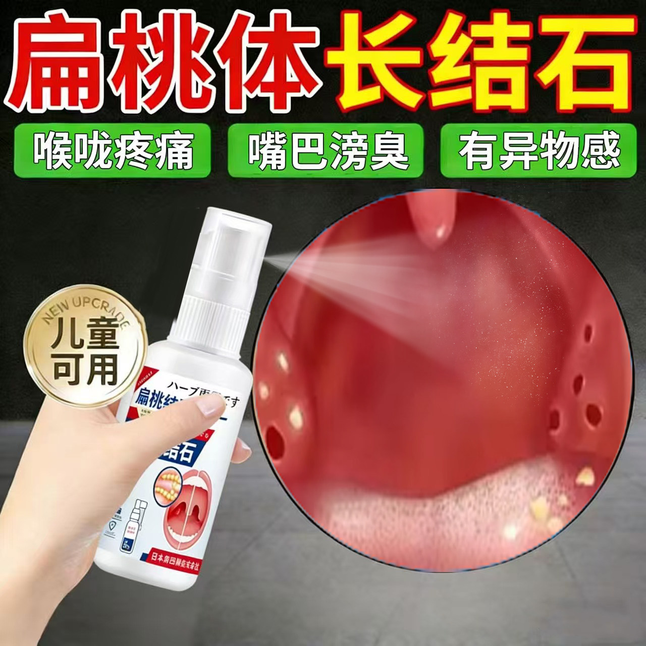 扁桃体结石发炎喷剂贴喉咙肿痛专用吞咽困难疼有异物感口臭肥大UU