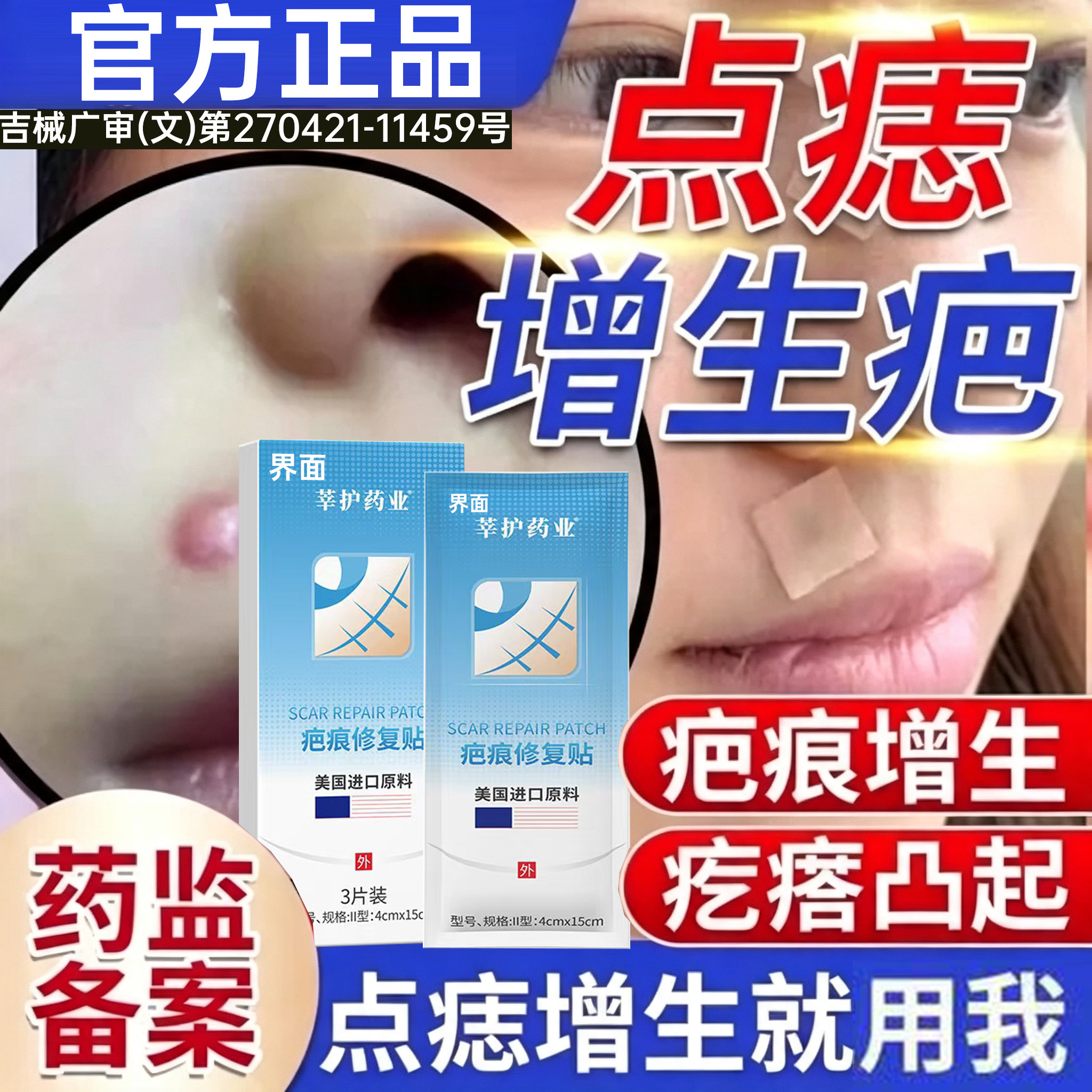 点痣疤痕修复贴医用硅酮凝胶疤痕贴去痣无痕正品去红印修复消印PP图片