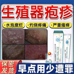 男士生殖器疱泡疹断药克星治疗阴茎根真菌感染病毒发特效膏立停GX