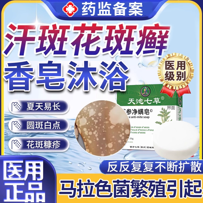 汗斑花斑癣专用特效香皂药膏快速消白斑硫磺皂沐浴露马拉色菌感UU