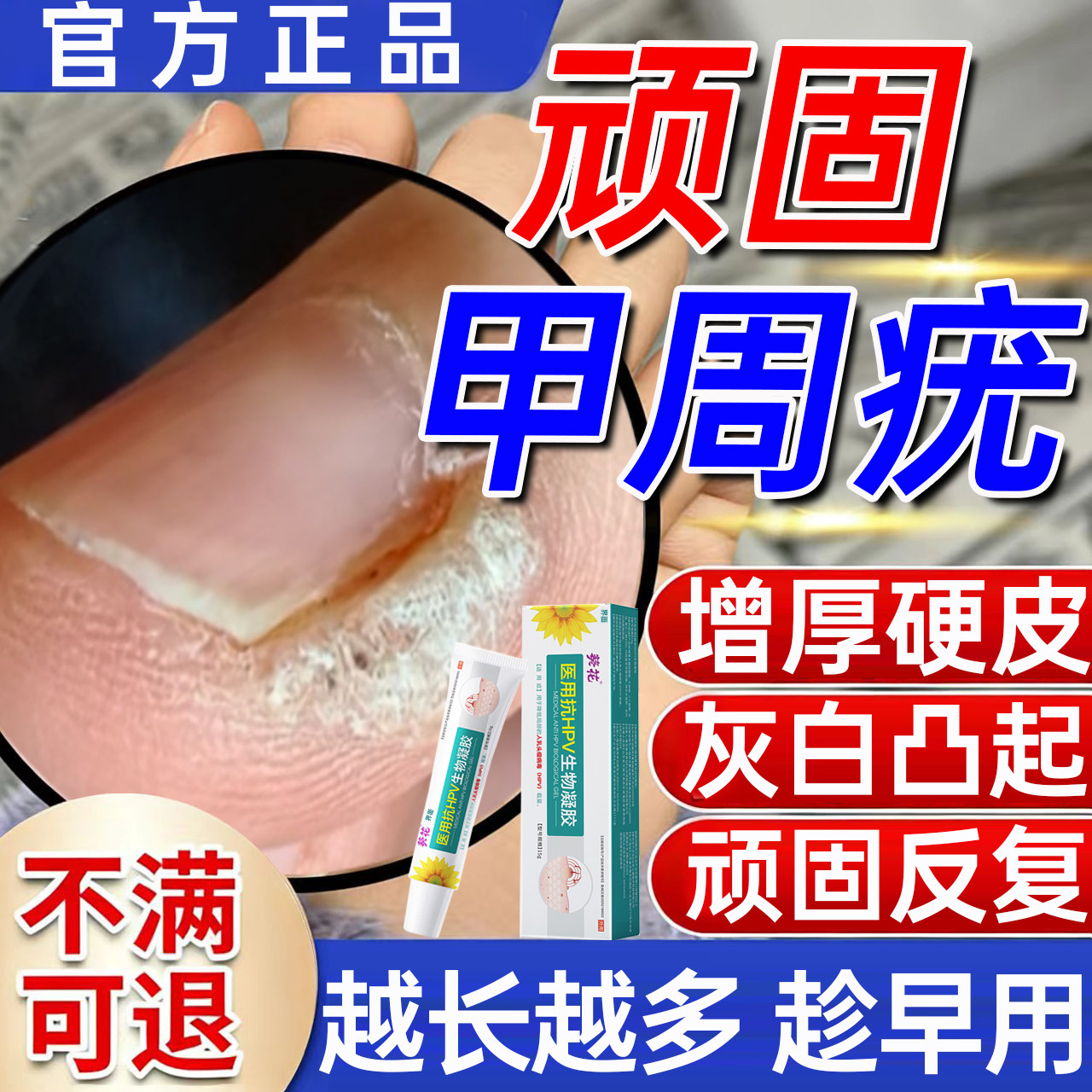 甲周疣甲下疣专用膏儿童可用手指长硬皮疙瘩瘊子寻常疣去除神器WY,医疗器械,保健理疗,淘宝优惠券,粉丝福利购,淘宝优惠卷