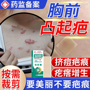 胸口疤痕疙瘩增生凸起硬肉祛疤贴胸前去除瘢痕除疤膏去疤隐形防MR