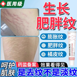 青少年肥胖纹修复霜去肥胖纹修复霜生长纹消除大腿学生男女腿上UU