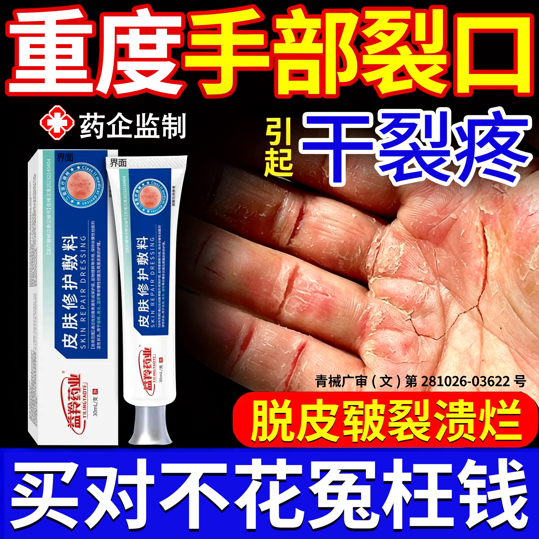 手指开裂口脱皮干燥粗糙修复霜蜕皮干燥起皮手蜕皮严重蜕皮专用FY