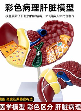 人体高度仿真肝脏解剖模型肝胆胰脾十二指肠病变器官结构教学模型