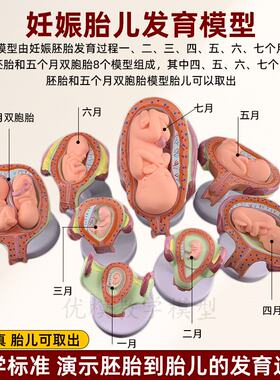 妊娠发育过程模型 胚胎计划生育模型 计生展示模型 胎儿模型 子宫