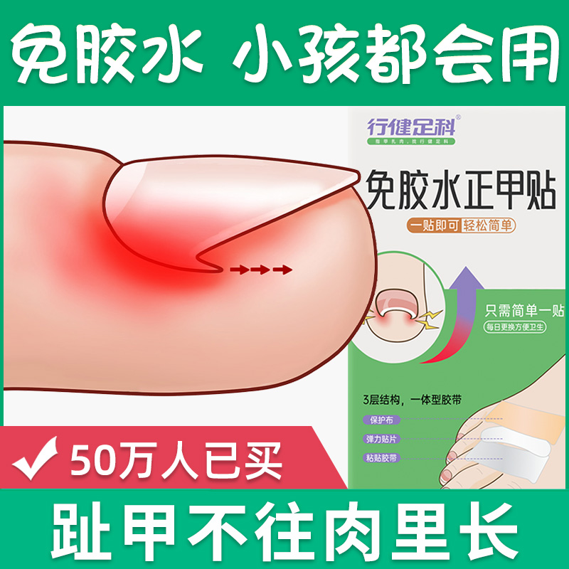 【行健足科】新一代免胶水正甲贴