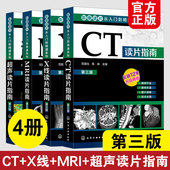 第三版 超声读片 CT读片 新版 MRI读片指南 影像读片从入门到精通系列 X线读片指南 基层影像医师影像技术科医师实用参考图书籍 4册