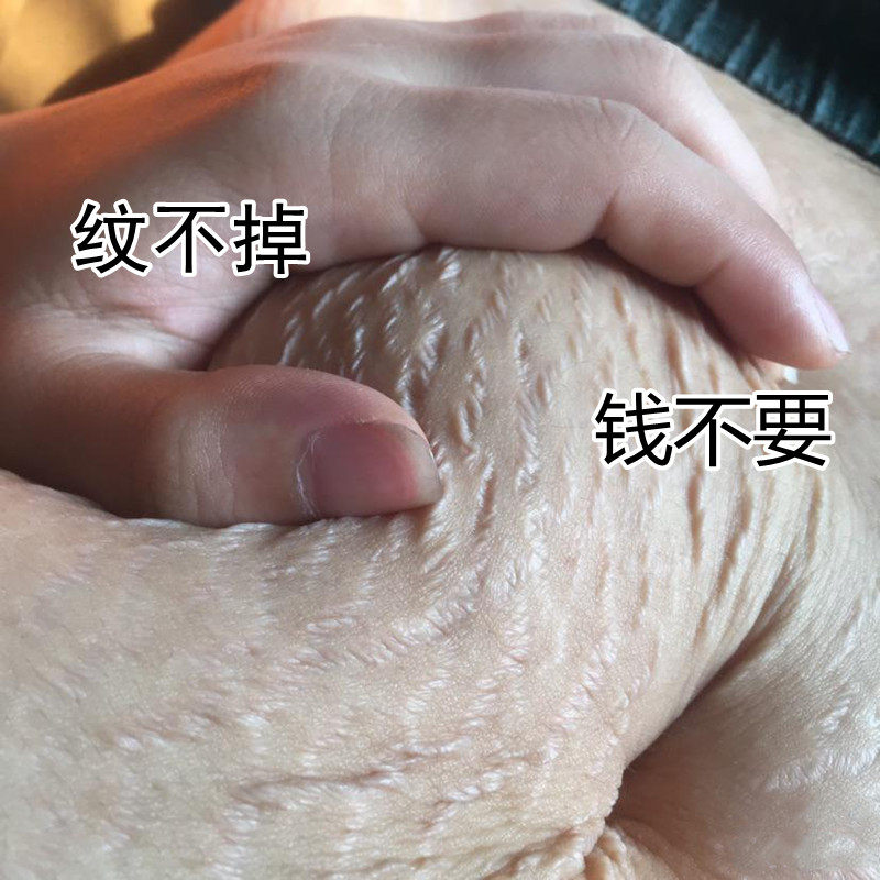 【2022妊娠纹克星】产后不要纹 哺乳期可用 宝妈福利 月销上万