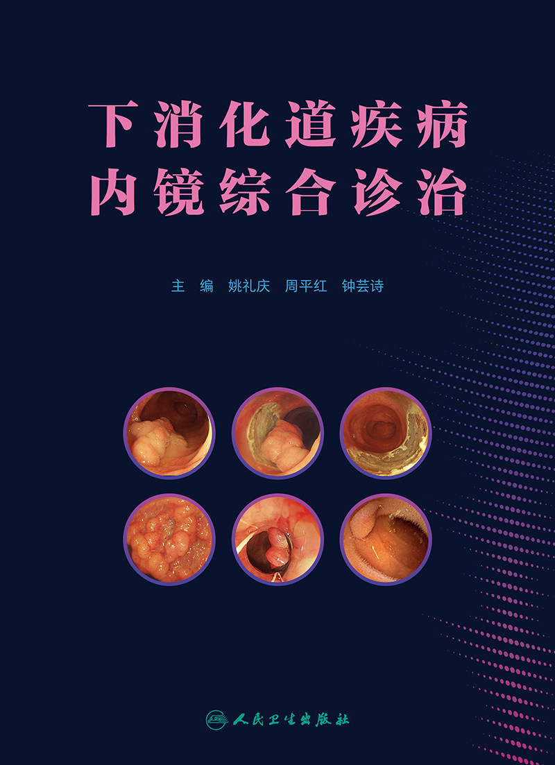 下消化道疾病内镜综合诊治 急诊胃与大肠十二指肠食管癌活检胃炎常见