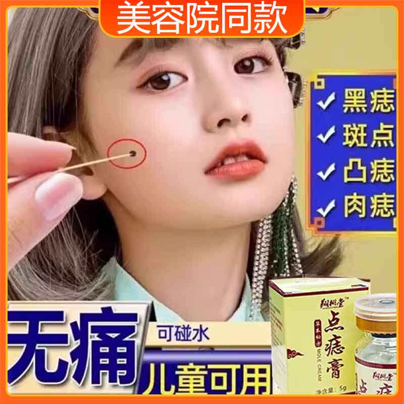 【0差评】点痣膏无痕正品脸部痦子取痣黑痣专用点痣神器黑点去除