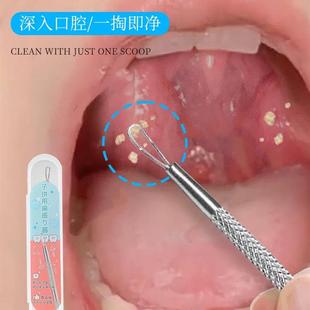 扁桃体去除工具结石取出隐窝神器口腔扁条体扁桃腺扁导体石清理器