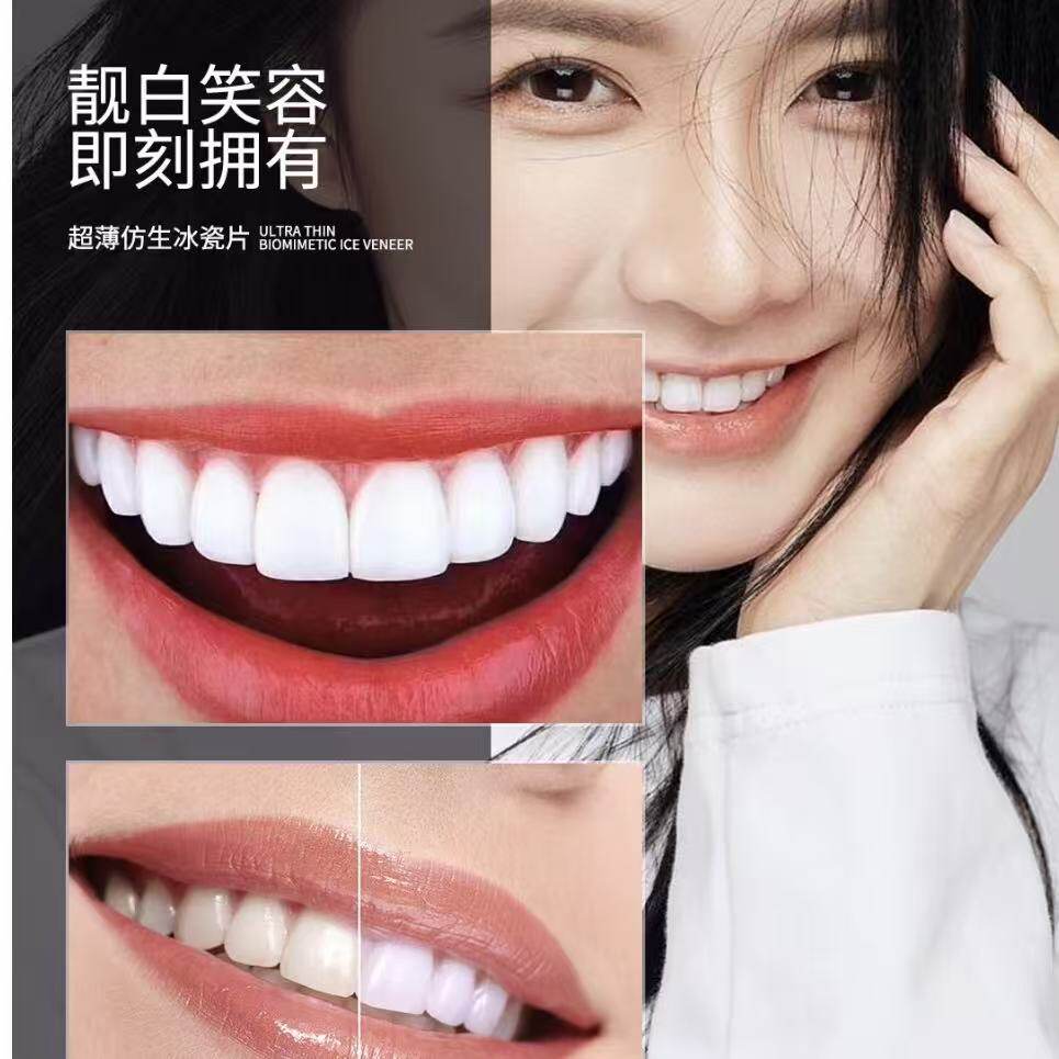 牙齿贴片牙齿瓷贴面全瓷牙贴面义口腔护理设备礼盒