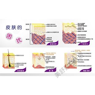 皮肤的困扰皮肤问题的成因皮肤结构图展板宣传画海报挂图定制kt板
