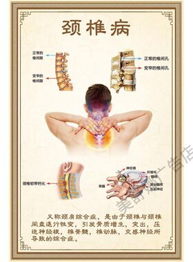 关节炎 人体关节 腰椎管狭窄症 肩周炎 颈椎病海报广告美容院挂图