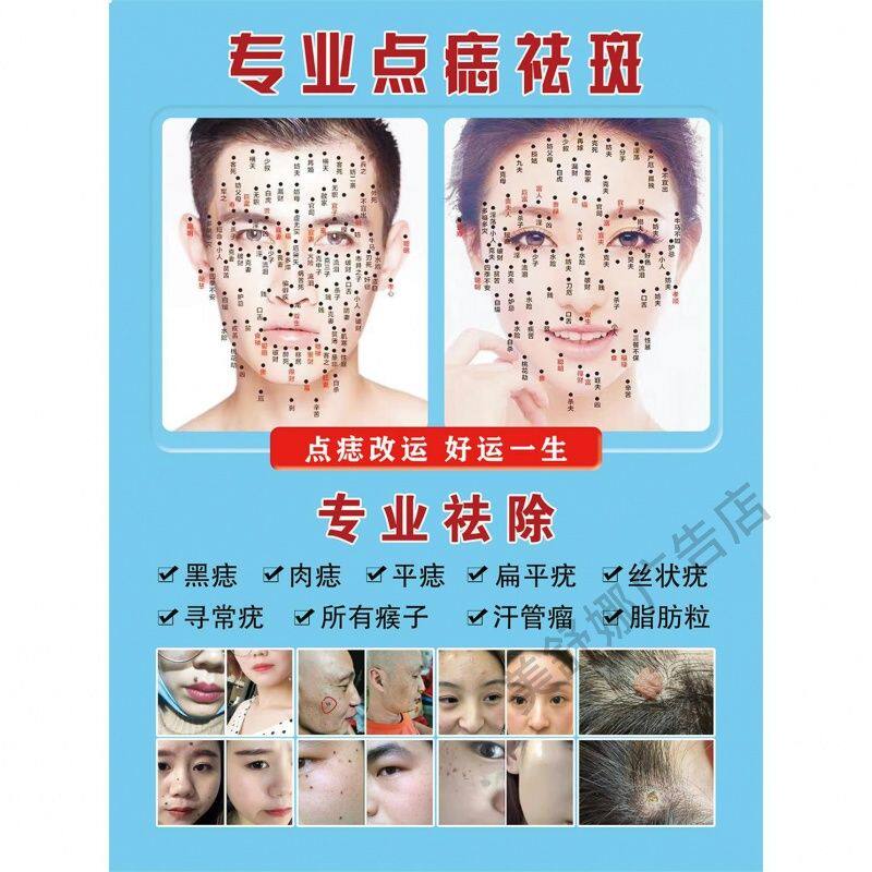 专业点痣宣传广告男女面痣图贴纸点痣广告图祛斑点疣去痣海报墙贴
