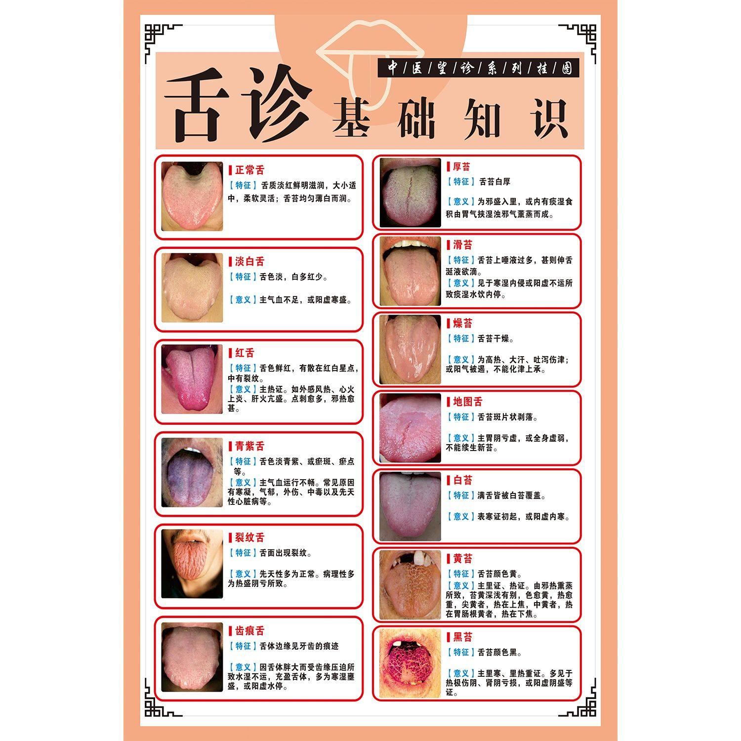 舌诊健康状况对照表图解中医理疗口腔疾病保健海报贴画医院挂图