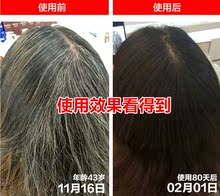 滋养育发液女男控油学生洗发露1