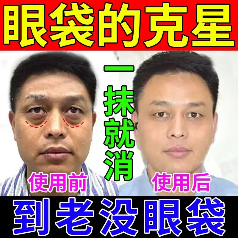 眼袋祛除神器男士精华液治眼袋贴膜消除祛去黑眼圈油女士专用眼霜