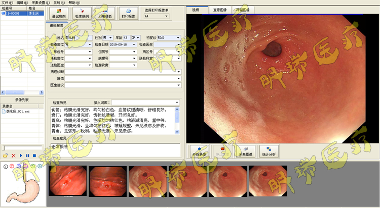 内镜工作站胃肠镜工作站软件内窥镜工作站+采集卡视频线脚踏开关