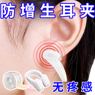 耳夹防增生耳洞耳垂术后防增生疤痕疙瘩压力贴/夹凸起去除疙瘩