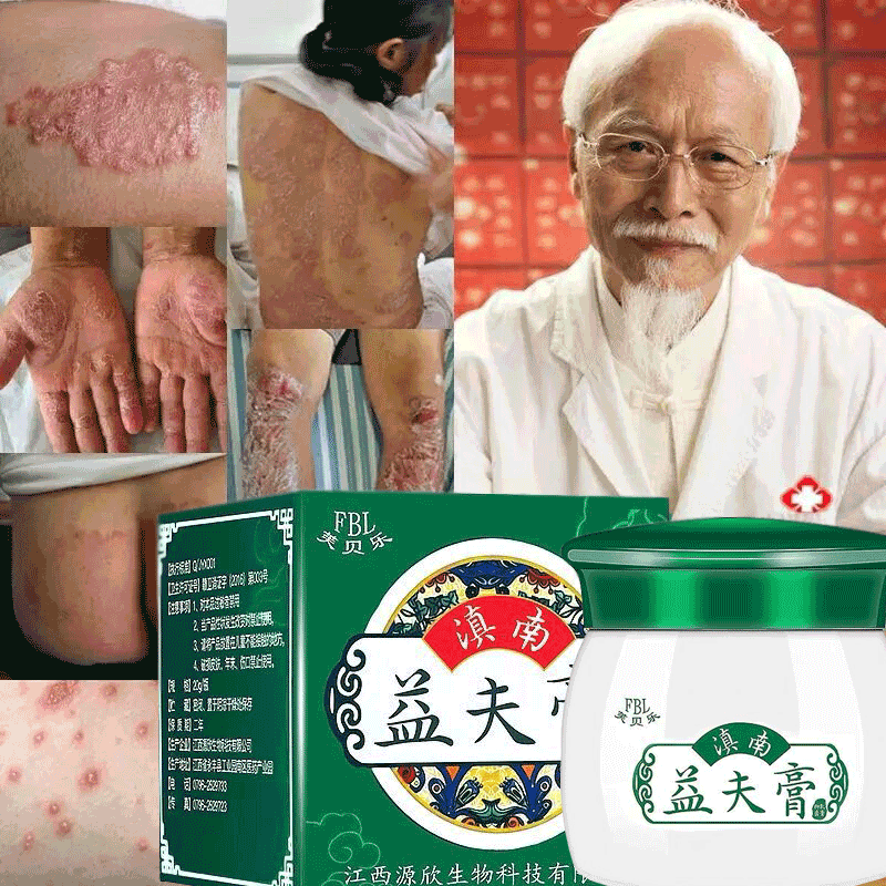滇南益夫膏芙贝乐顽固湿疹外用止痒皮肤专用皮炎根干燥去痒抑菌膏