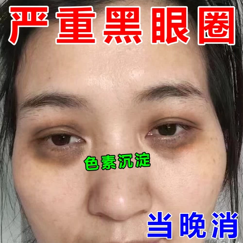 Мужской осветляющий крем для глаз от мешков под глазами, против темных кругов под глазами, против морщин