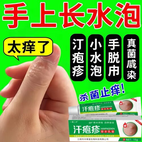 手上起小水泡汗疱泡疹止痒中药抑菌鹅掌风真菌感染手气湿痒专用膏