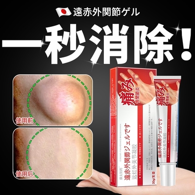 皮肤纤维消瘤膏皮下脂肪瘤特肿硬块去腺囊手指肿胀变形凝胶旗舰店