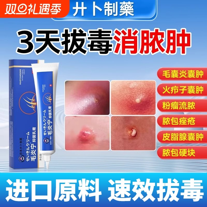 鱼石脂软膏正品疖肿火疖子毛囊炎非专用药拔毒消抑菌消肿药炎膏乳