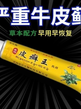 安兴堂藏药皮癣王乳膏20g皮肤外用抑菌软膏