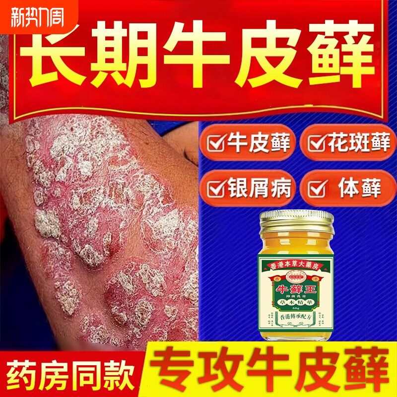 香港牛藓王牛皮痒癣头皮股银去屑病专用膏正品皮肤杀菌止痒抑菌