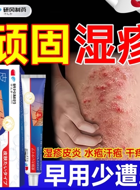 皮肤湿疹膏止痒外用去顽固皮炎疹肛周肛门阴囊汗泡疱角化型软膏根
