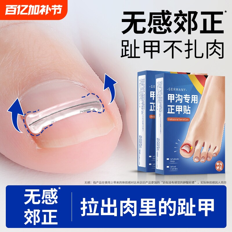 甲沟嵌甲指甲矫正器正甲贴片贴片脚趾专用工具指甲刀趾甲炎钢丝