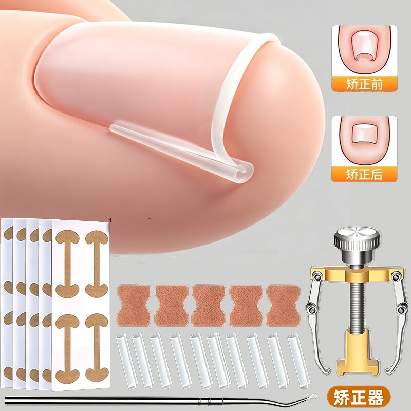 甲沟矫正器指甲扎肉嵌甲专用防脚指甲往肉里长专用隔离工具填充垫